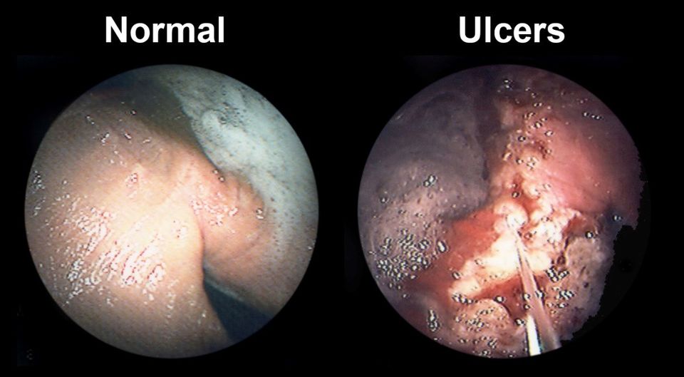 equine gastric ulcers